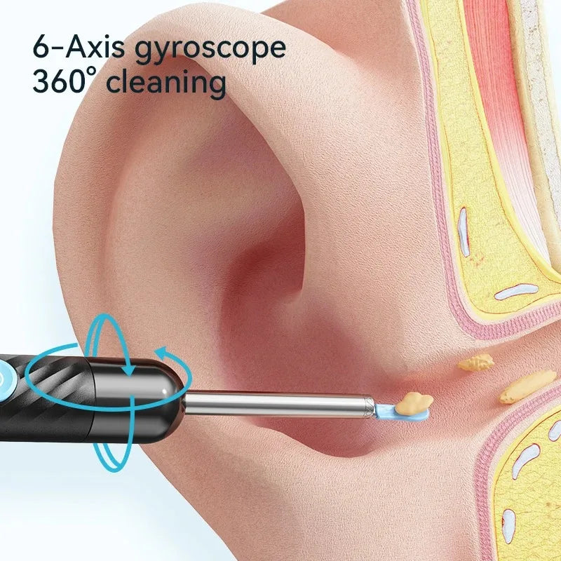 Wireless Ear Wax Removal With Camera Rechargeable Ear Cleaner HD Check Camera with Ear Spoon Set Canal Clean