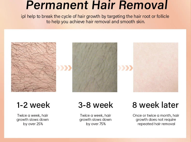 KODO 2026 High-end customization ice Laser Hair removal Laser Epilator Permanent IPL Painless Photoepilator 4 in 1 face and body
