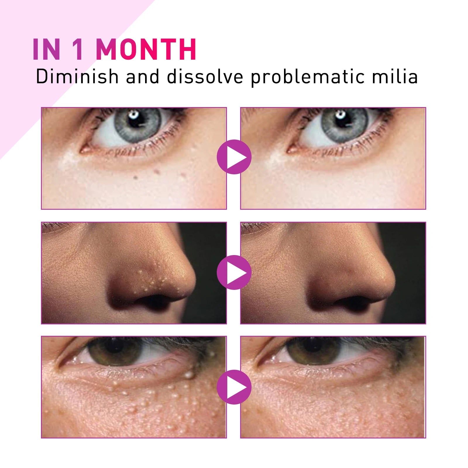 Eye care essence lotion gently cares for the skin around the eyes, providing particle protection, nourishment, and hydration.