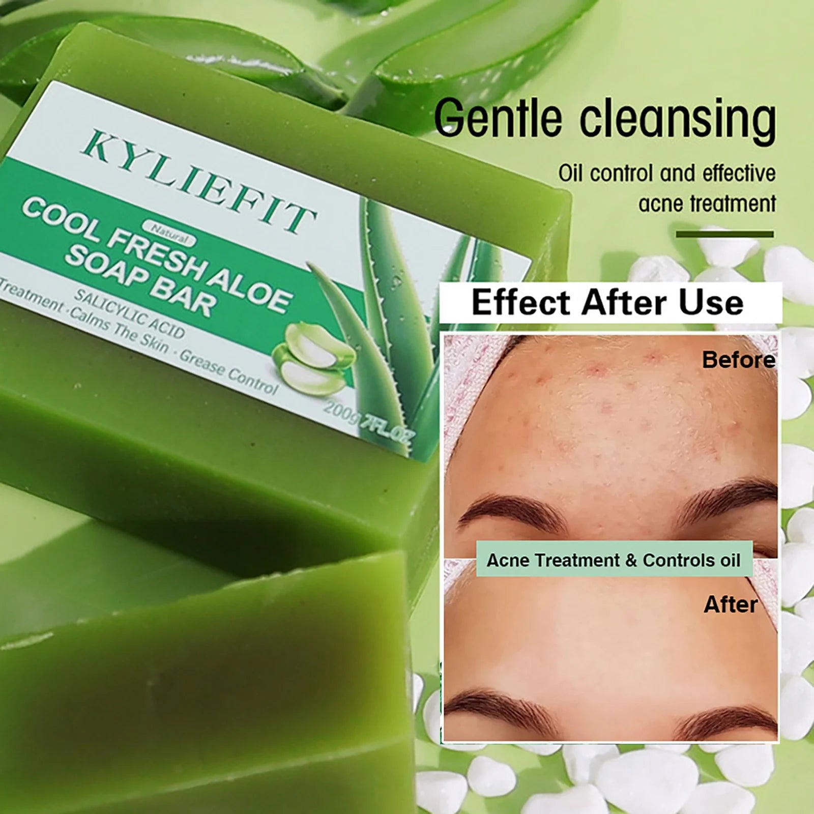 AILKE Aloe Vera Whitening Soap, Remove Acne, Spots, Skin Radiant, Improve Skin Luster, Vegan Bath Wash for All Skin Types, 200g Ürün ana görseli