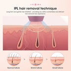 Laser Epilator IPL Hair Removal Laser Epilator For Women 500,000 Flash Depilator Pulses Permanent Painless Hair Removal