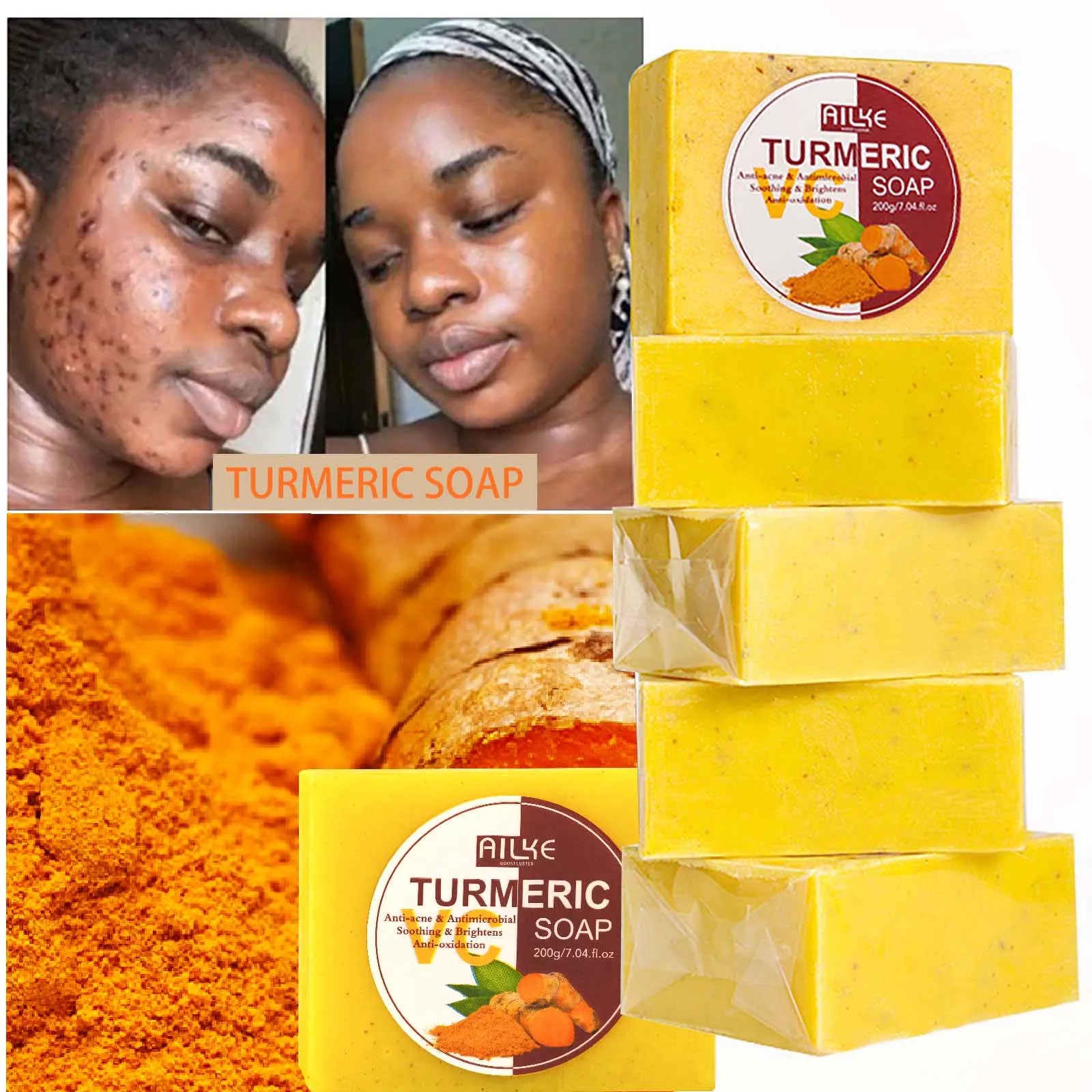 AILKE Natural Turmeric Bath Soap for Face, Body, Hands, Lightening, Cleaning, Even Skin Tone, Anti Dark Spots and Acne, 200g Ürün ana görseli