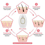 500000 Flash Painless Laser IPL Epilator Women Shaver Permanent Hair Removal For Body Face Bikini Underarm Hair Removal Machine