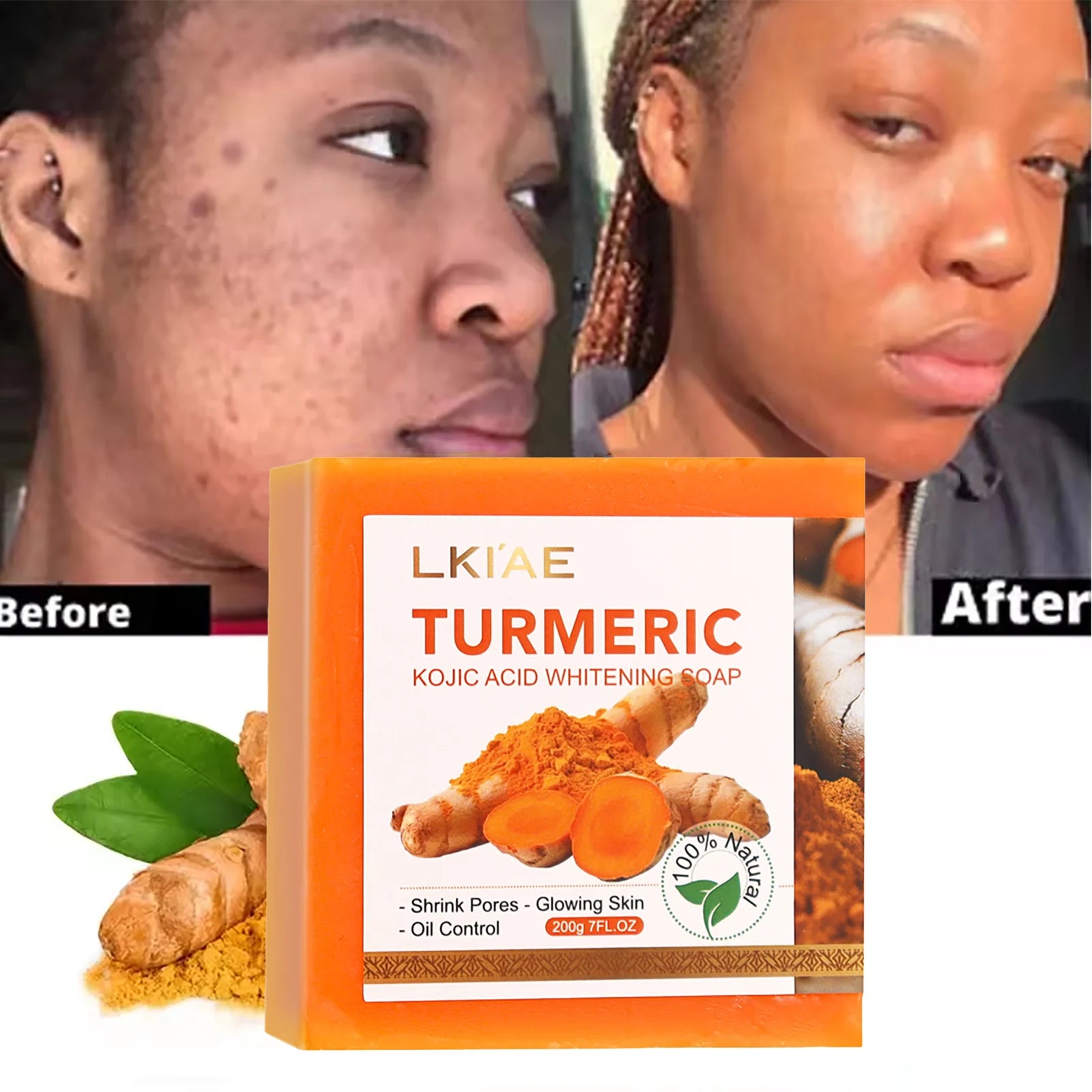LKIAE Organic Turmeric Soap Bar, Natural Herbal Hand Made Whitening Soap, Remove Melanin, Acne, Spots, For Face And Body,200g Ürün ana görseli