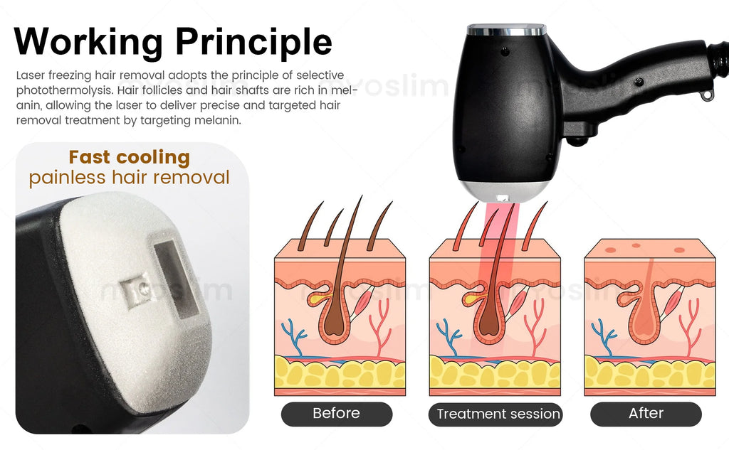 808nm Diode Laser Hair Removal Machine FAC TEC 5000W 4 Wavelength Ice Titanium Permanent Painless Removal Body Care Equipment