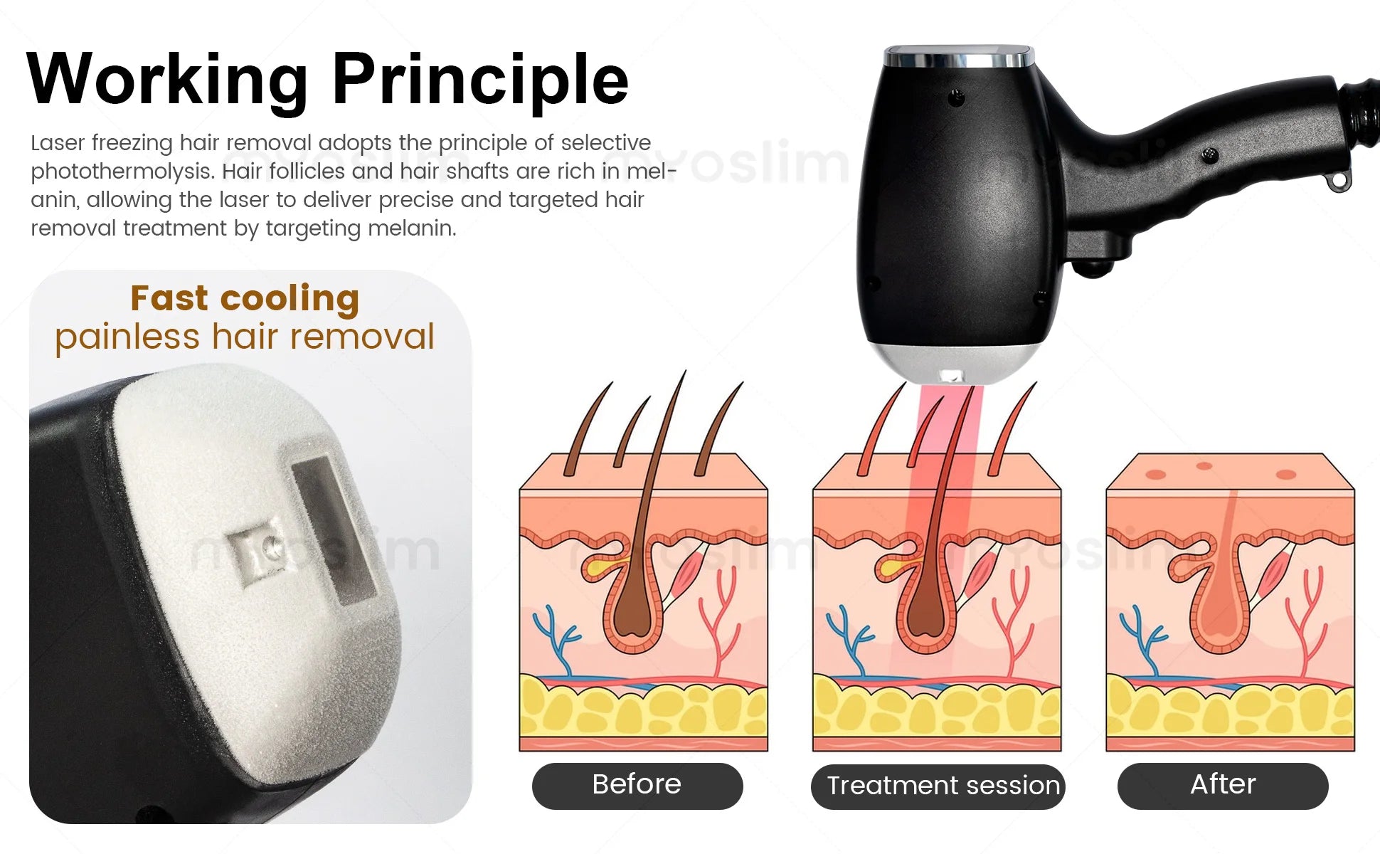 808nm Diode Laser Hair Removal Machine FAC TEC 5000W 4 Wavelength Ice Titanium Permanent Painless Removal Body Care Equipment
